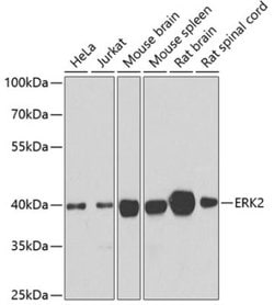 Vanilloid R-like 3/TRPV3 Rabbit anti-Human, Mouse, Rat, Polyclonal, Novus